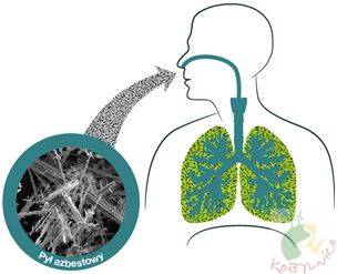 Wpływ azbestu na ludzki organizm